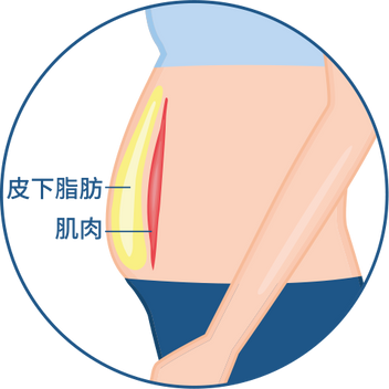 Emsculpt Neo 增肌減脂 Fit Firm Btl 香港官方網站