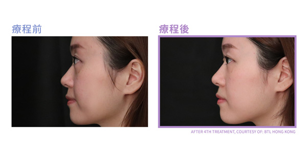 全面成效見證2